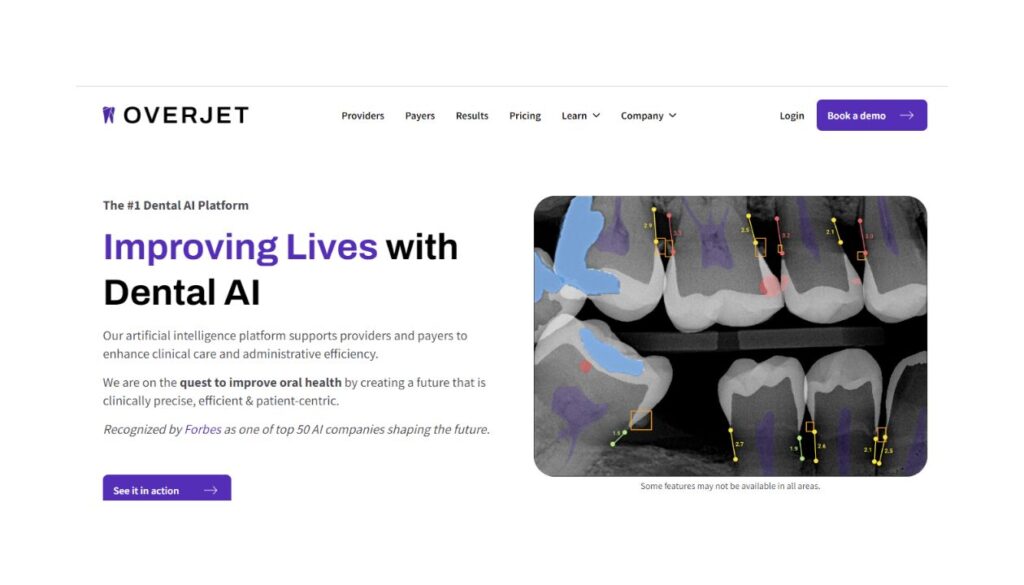 Overjet