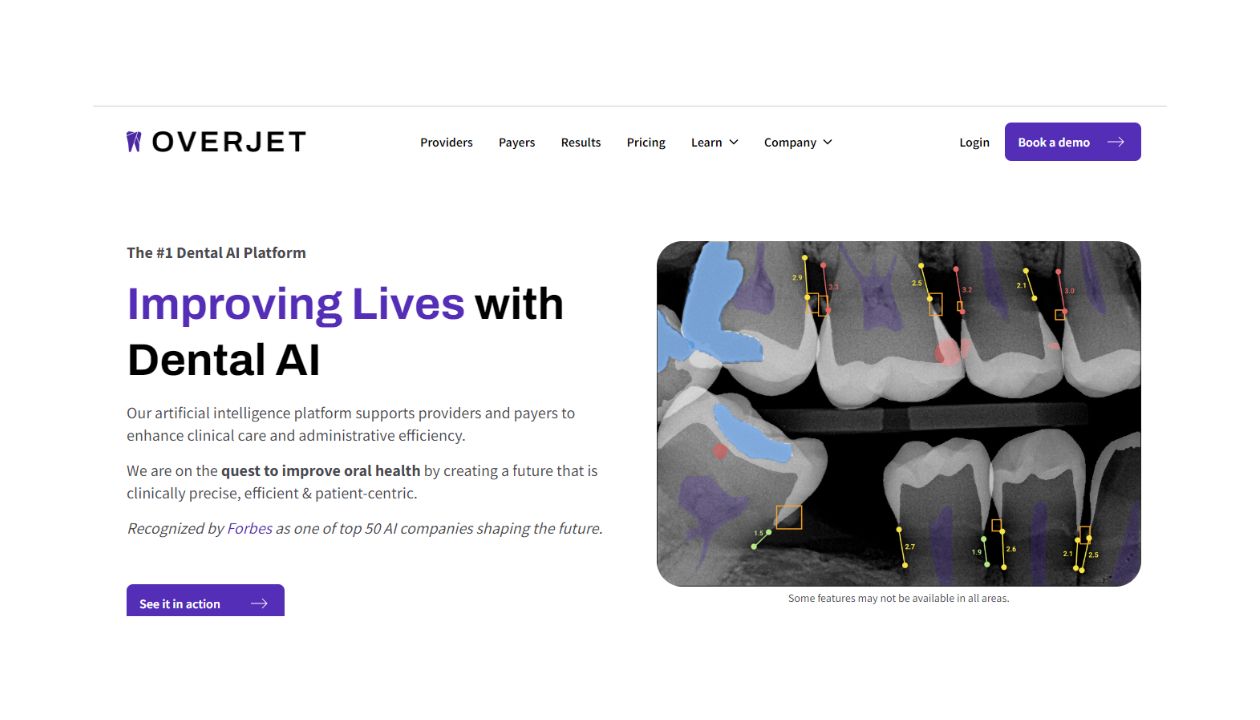 Overjet